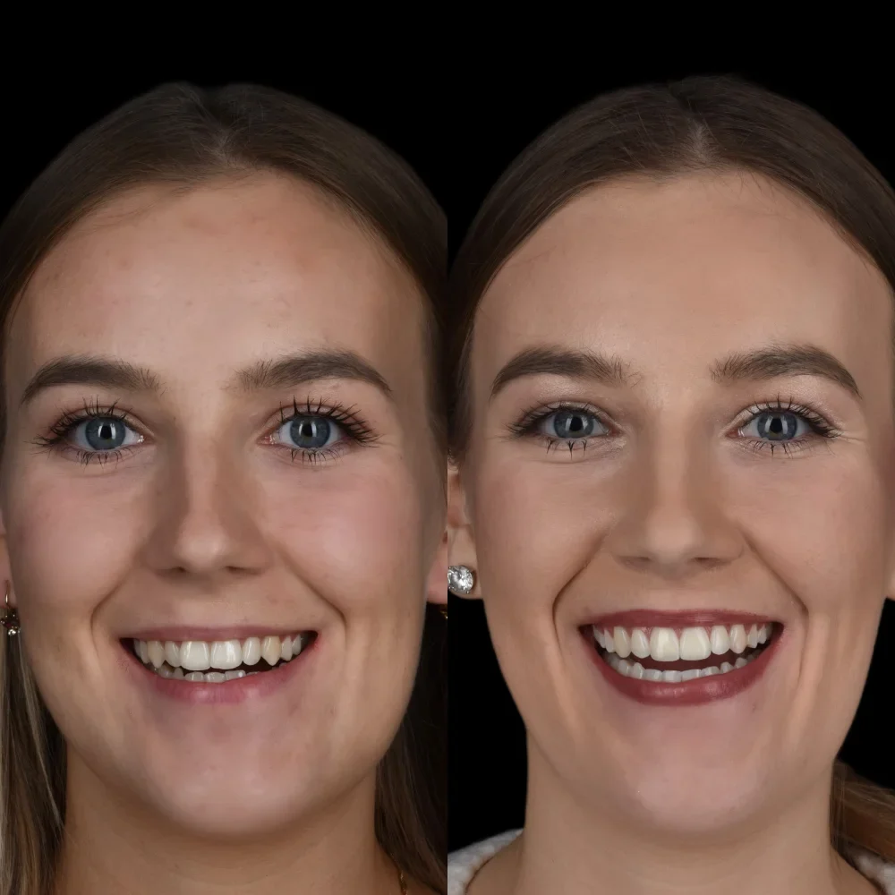 Unident-union-metamorfozy-photo-output-90-1