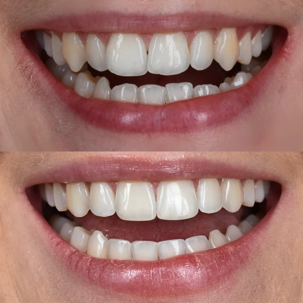 Unident-union-metamorfozy-photo-output-91-1