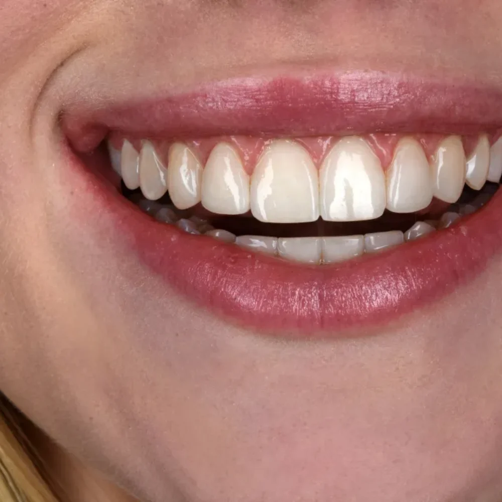 Unidentunion-metamorfozy-DSC_0417pop korekta