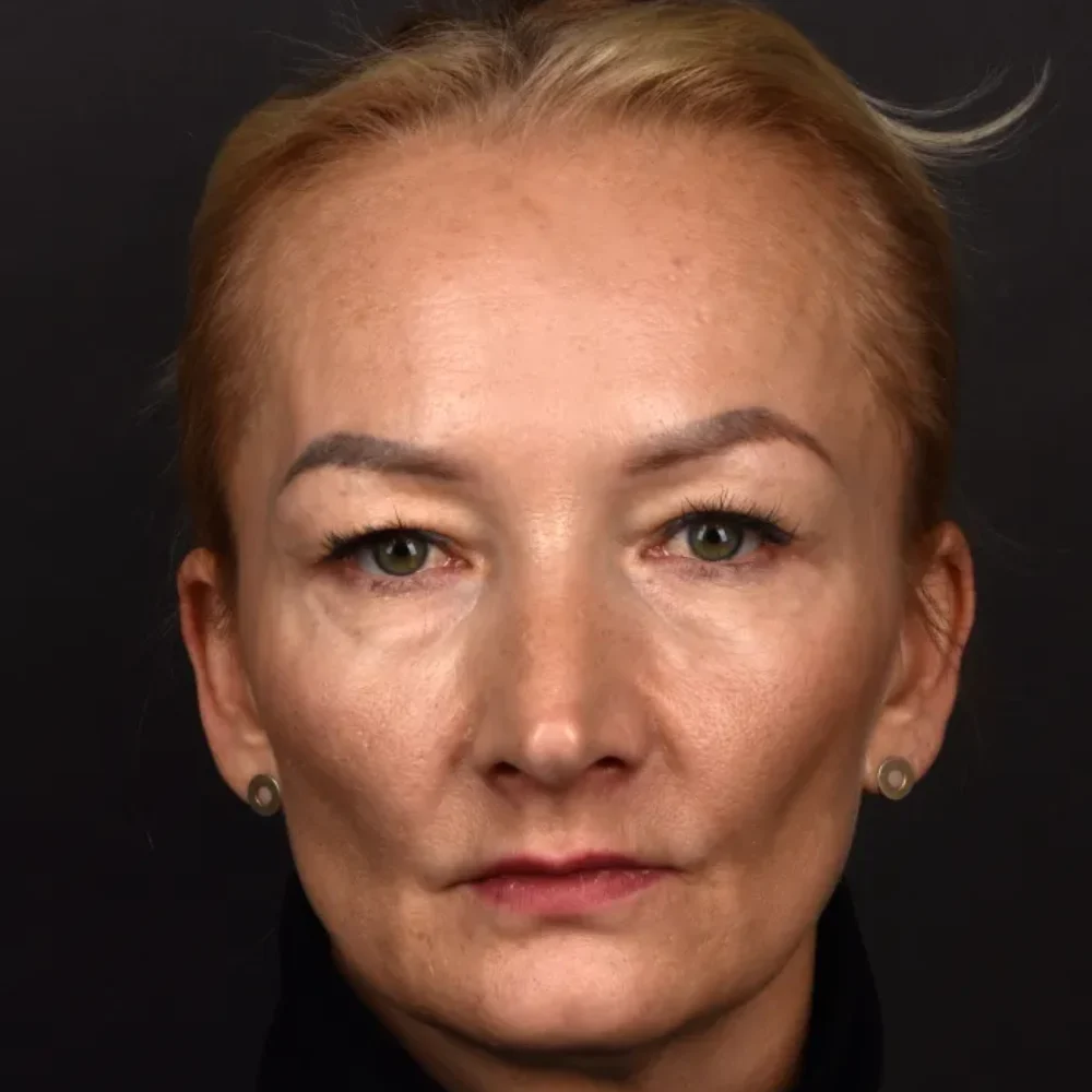 Unidentunion-metamorfozy-DSC_0922pop