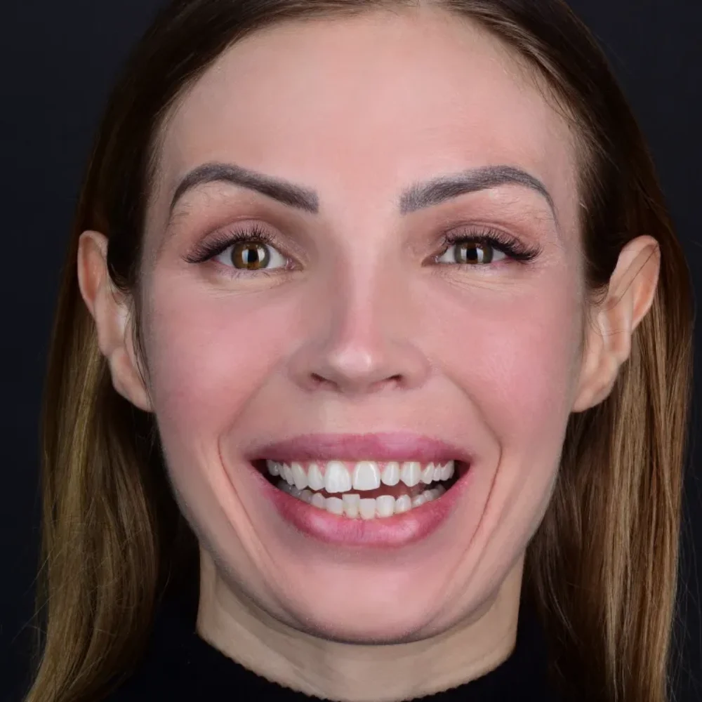 Unidentunion-metamorfozy-DSC_1373pop