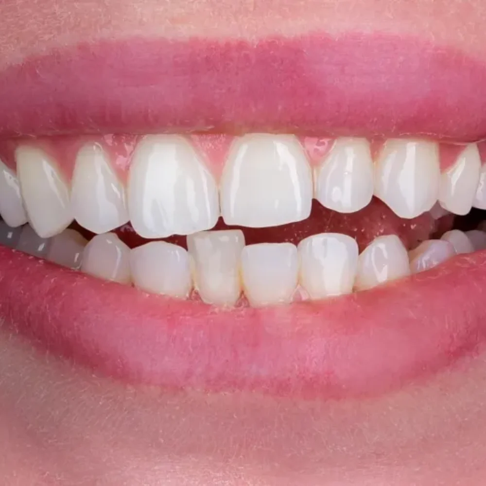 Unidentunion-metamorfozy-DSC_1376pop