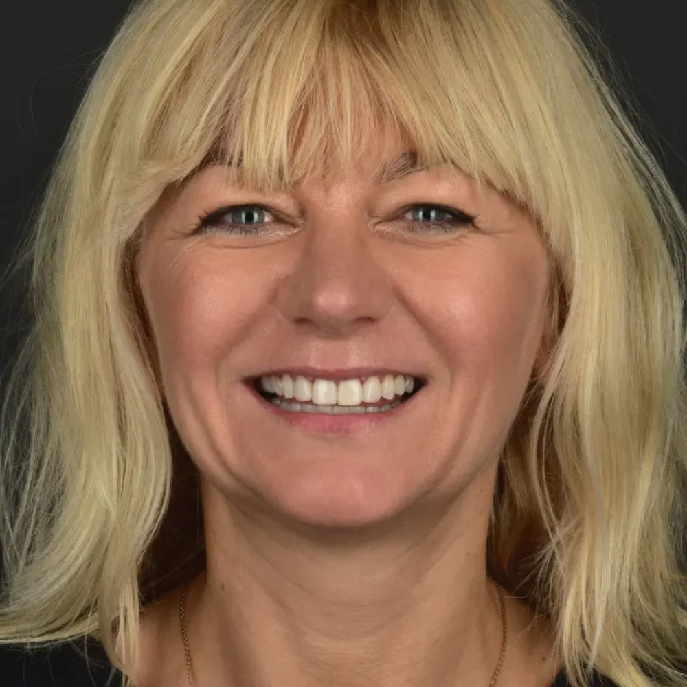 Unidentunion-metamorfozy-DSC_2063pop korekta