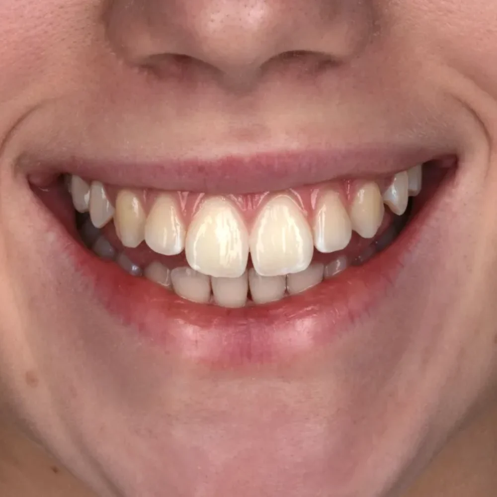 Unidentunion-metamorfozy-DSC_3616pop