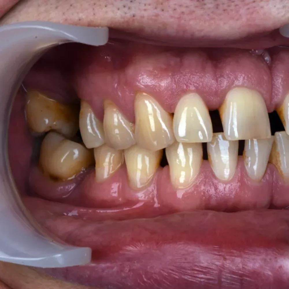 Unidentunion-metamorfozy-DSC_4605pop