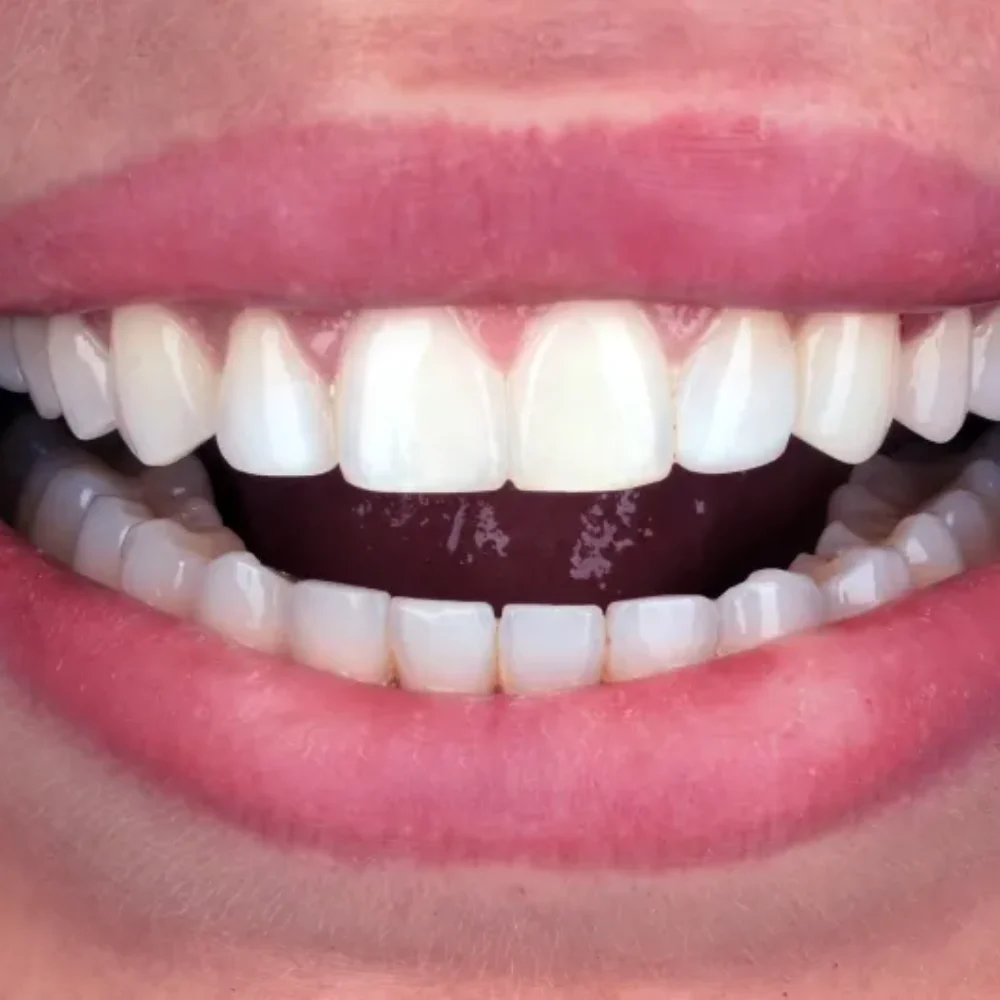 Unidentunion-metamorfozy-DSC_5443pop