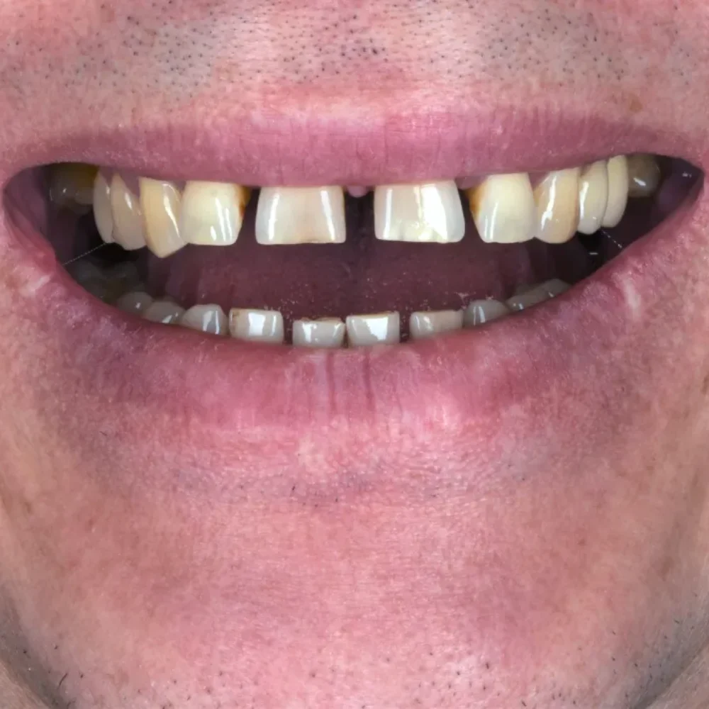 Unidentunion-metamorfozy-DSC_6529pop