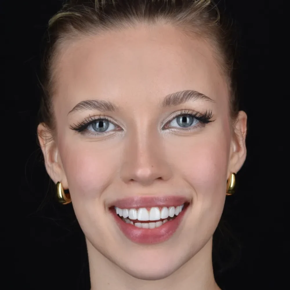 Unidentunion-metamorfozy-DSC_7471pop