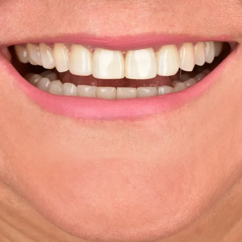 Unidentunion-metamorfozy-DSC_8841 pop korekta