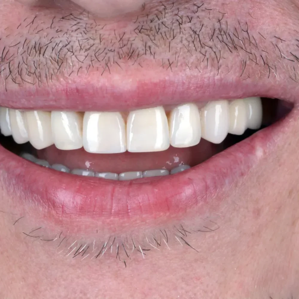 Unidentunion-metamorfozy-DSC_9025pop1