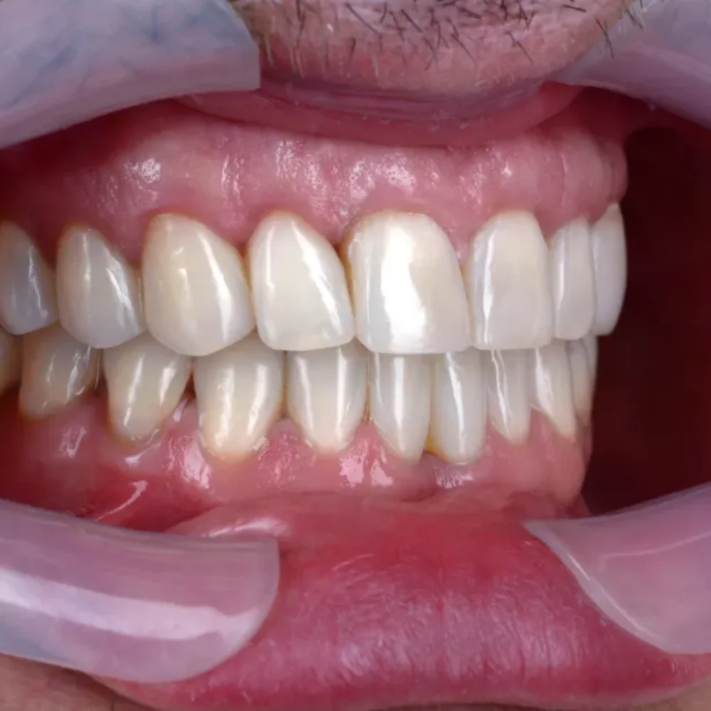 Unidentunion-metamorfozy-DSC_9037pop1