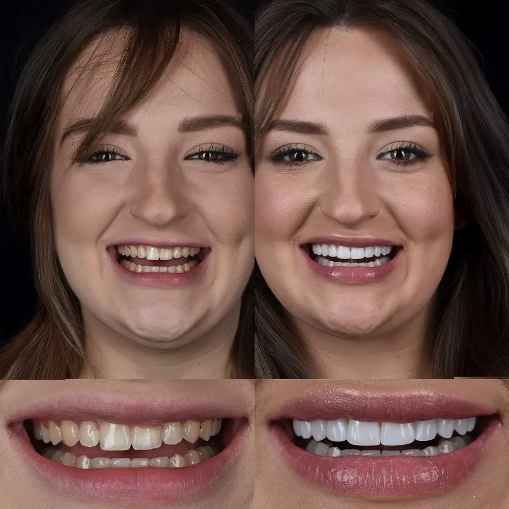 Unidentunion-metamorfozy-Frame 155