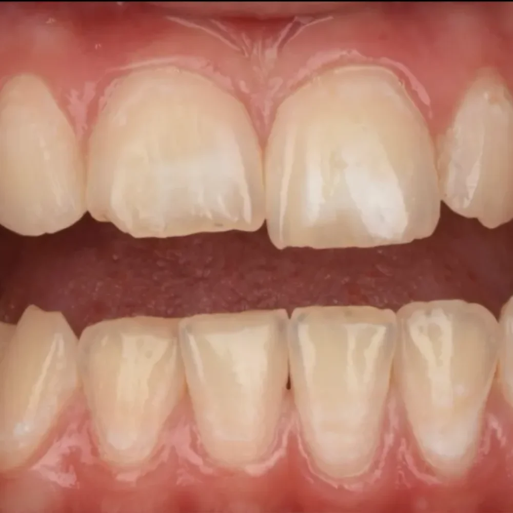 Unidentunion-metamorfozy-IMG_1548