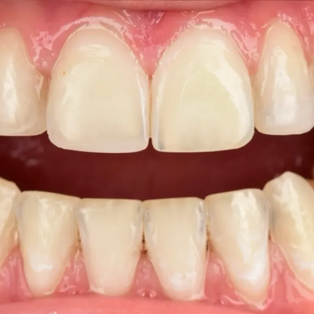 Unidentunion-metamorfozy-IMG_1549