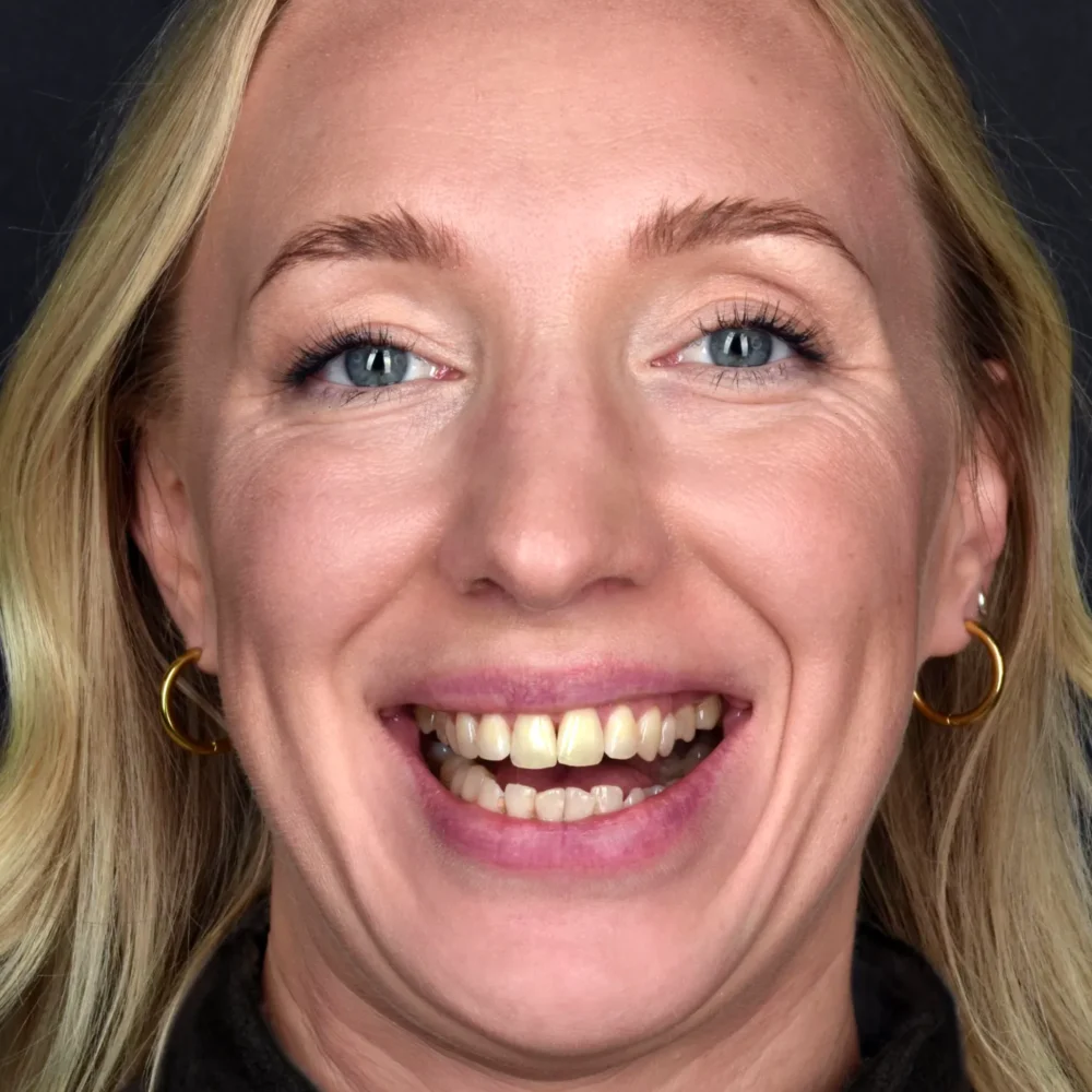 Unidentunion-metamorfozy-IMG_8980 pop