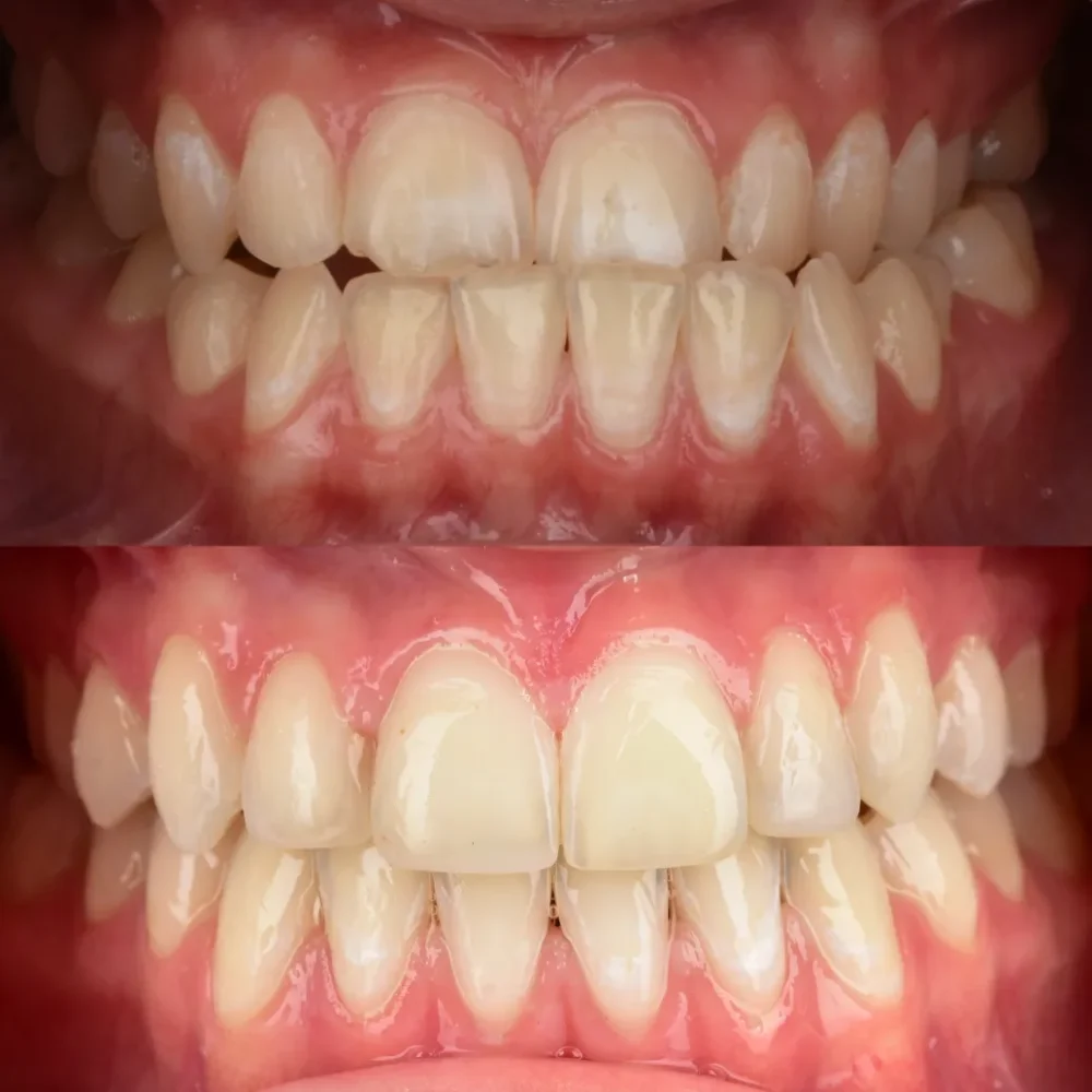 Unidentunion-metamorfozy-photo-output 100