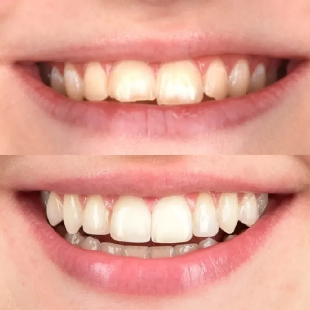 Unidentunion-metamorfozy-photo-output 102