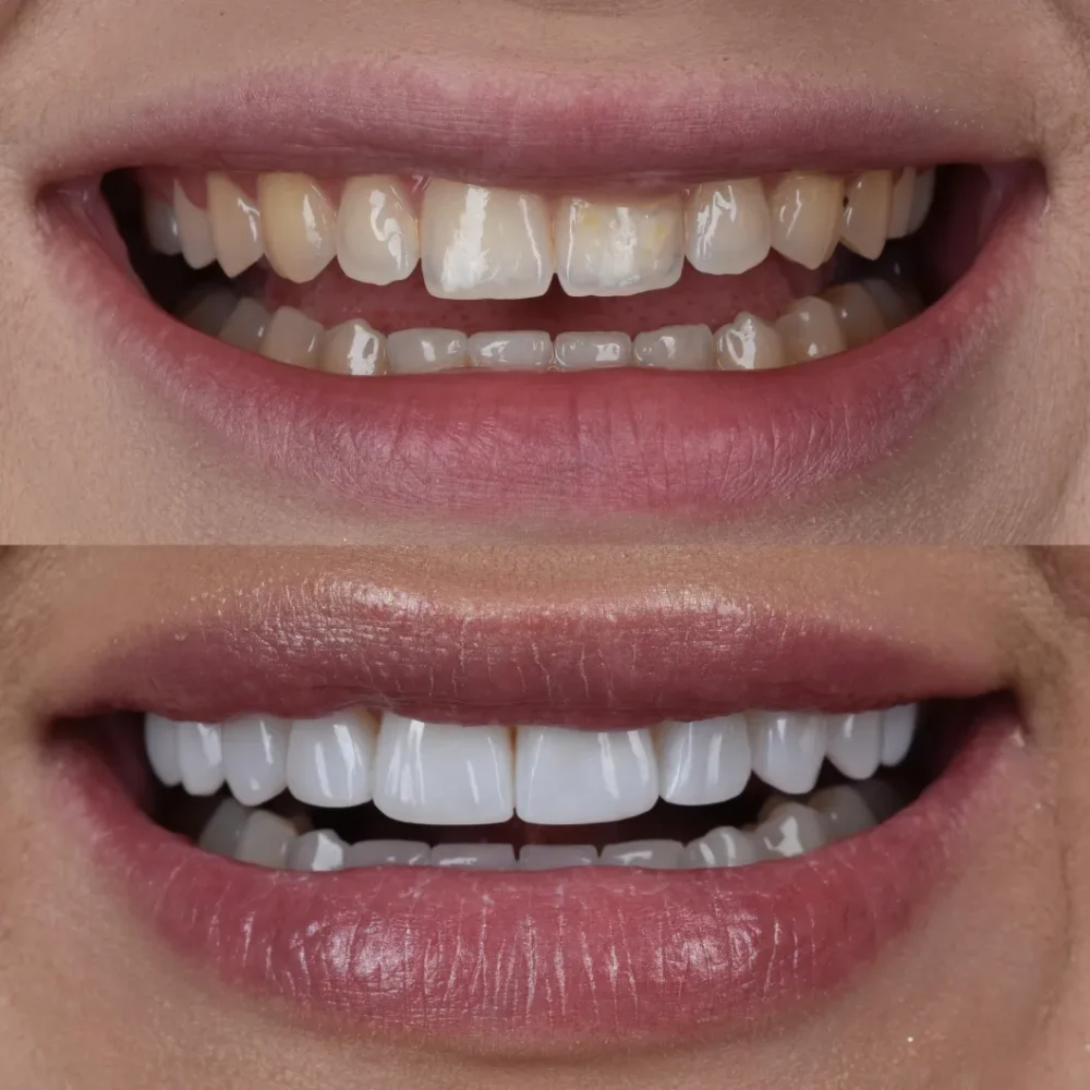 Unidentunion-metamorfozy-photo-output 118