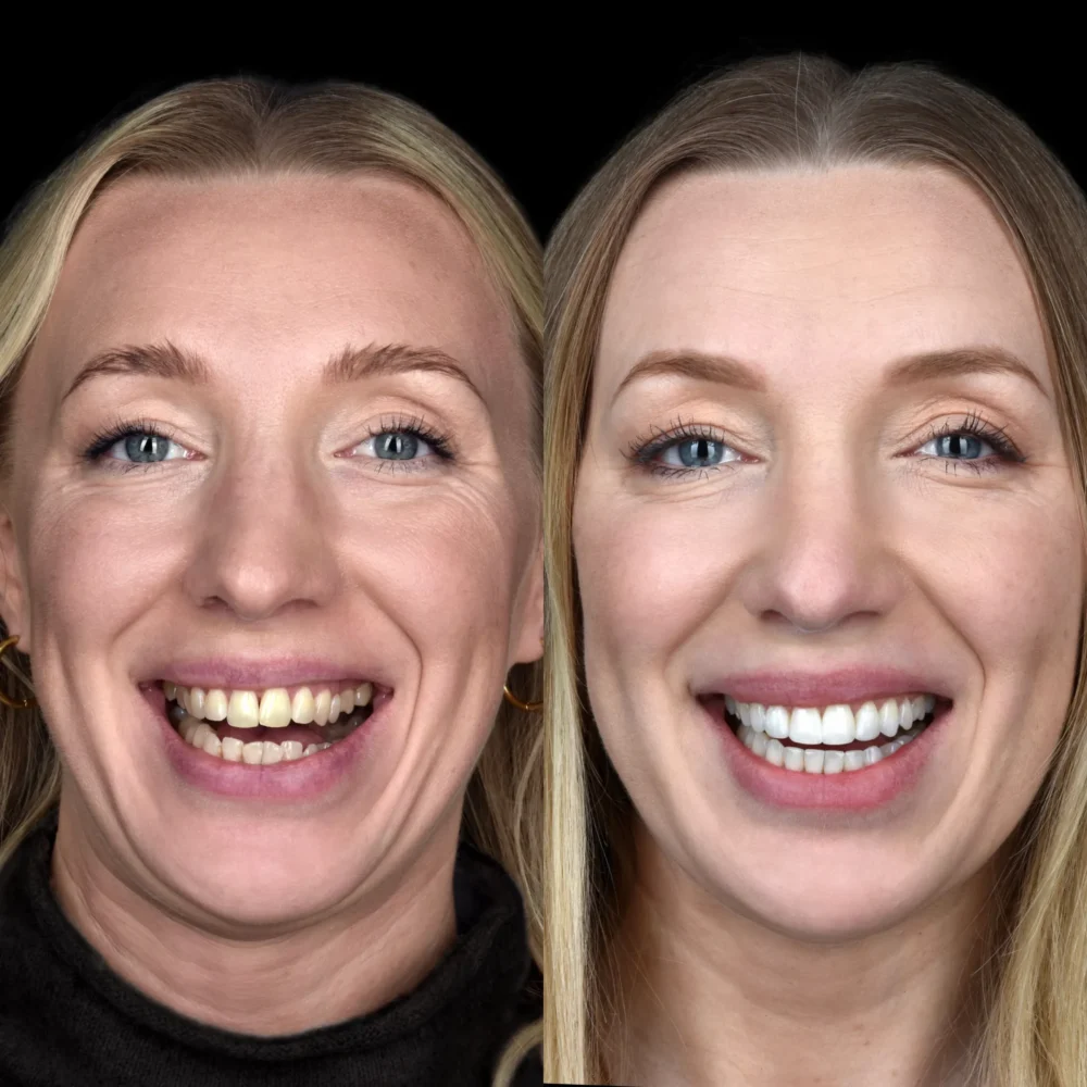 Unidentunion-metamorfozy-photo-output 126