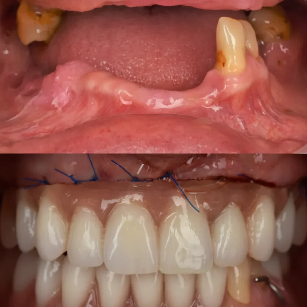 Unidentunion-metamorfozy-photo-output 169