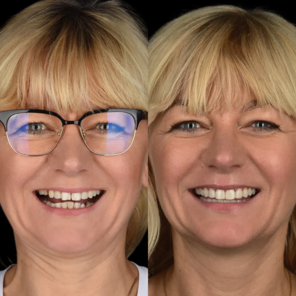 Unidentunion-metamorfozy-photo-output 70