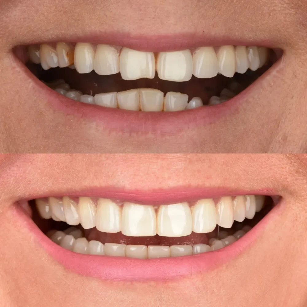 Unidentunion-metamorfozy-photo-output 72