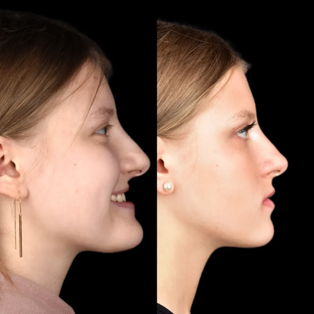 Unidentunion-metamorfozy-photo-output 99