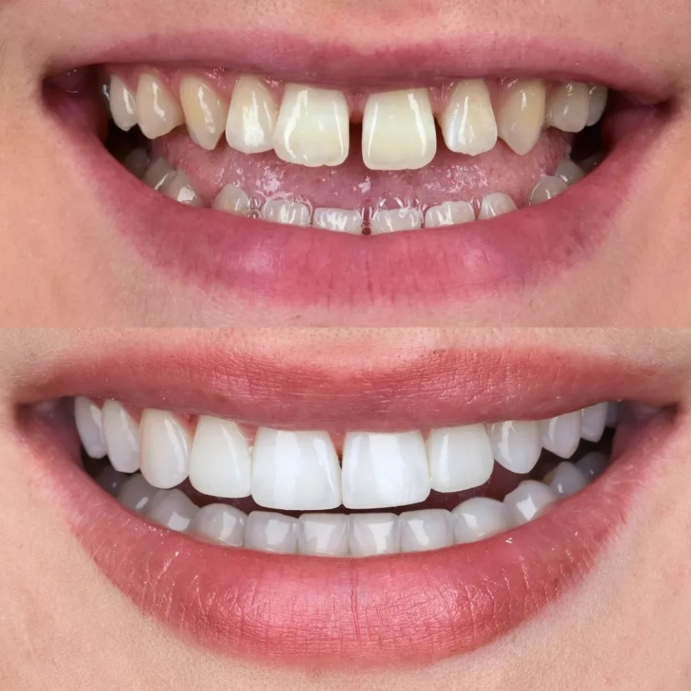 frame-170Unident-Union-metamorfoza-