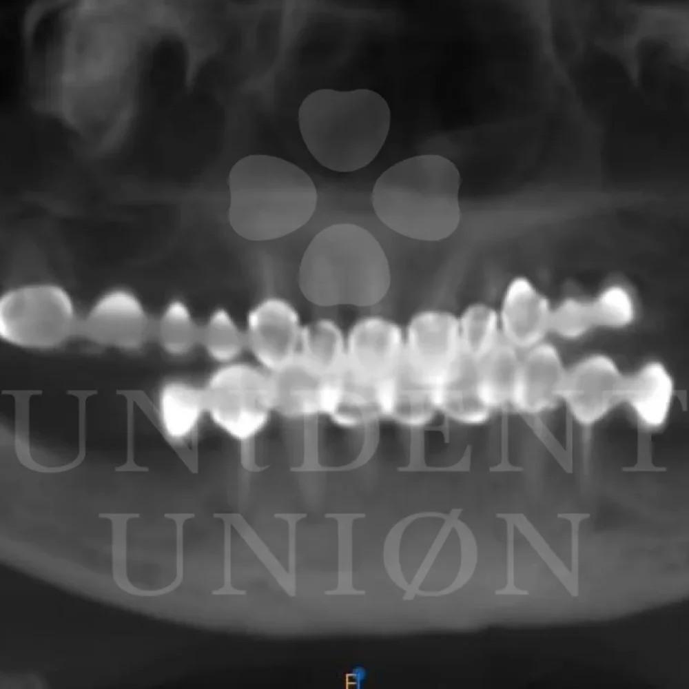 przypadek-2-chirurgia1