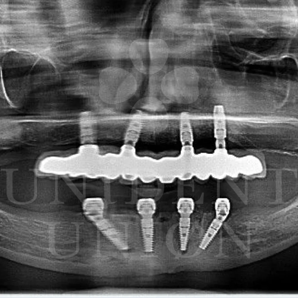 przypadek-2-chirurgia2