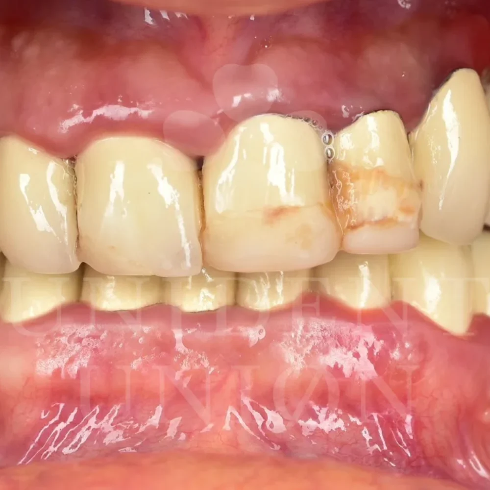 przypadek-2-chirurgia3