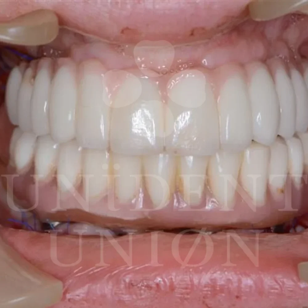 przypadek-2-chirurgia4