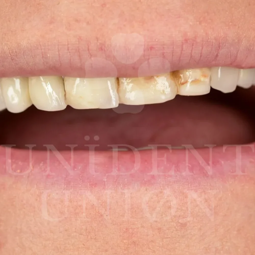 przypadek-2-chirurgia5