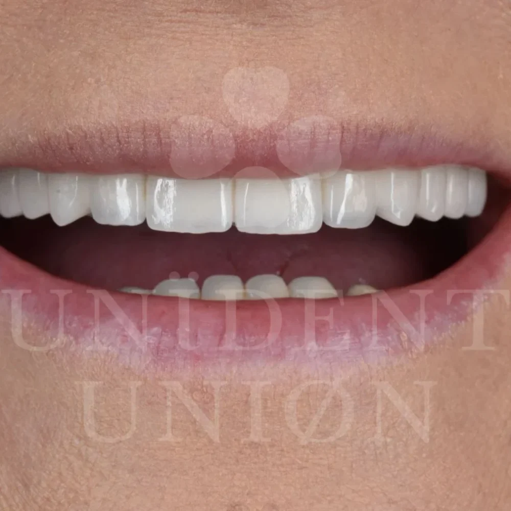 przypadek-2-chirurgia6