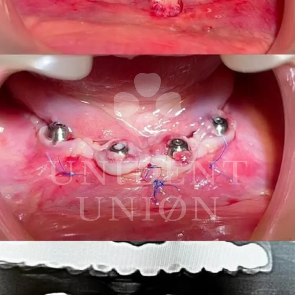 przypadek-2-chirurgia7