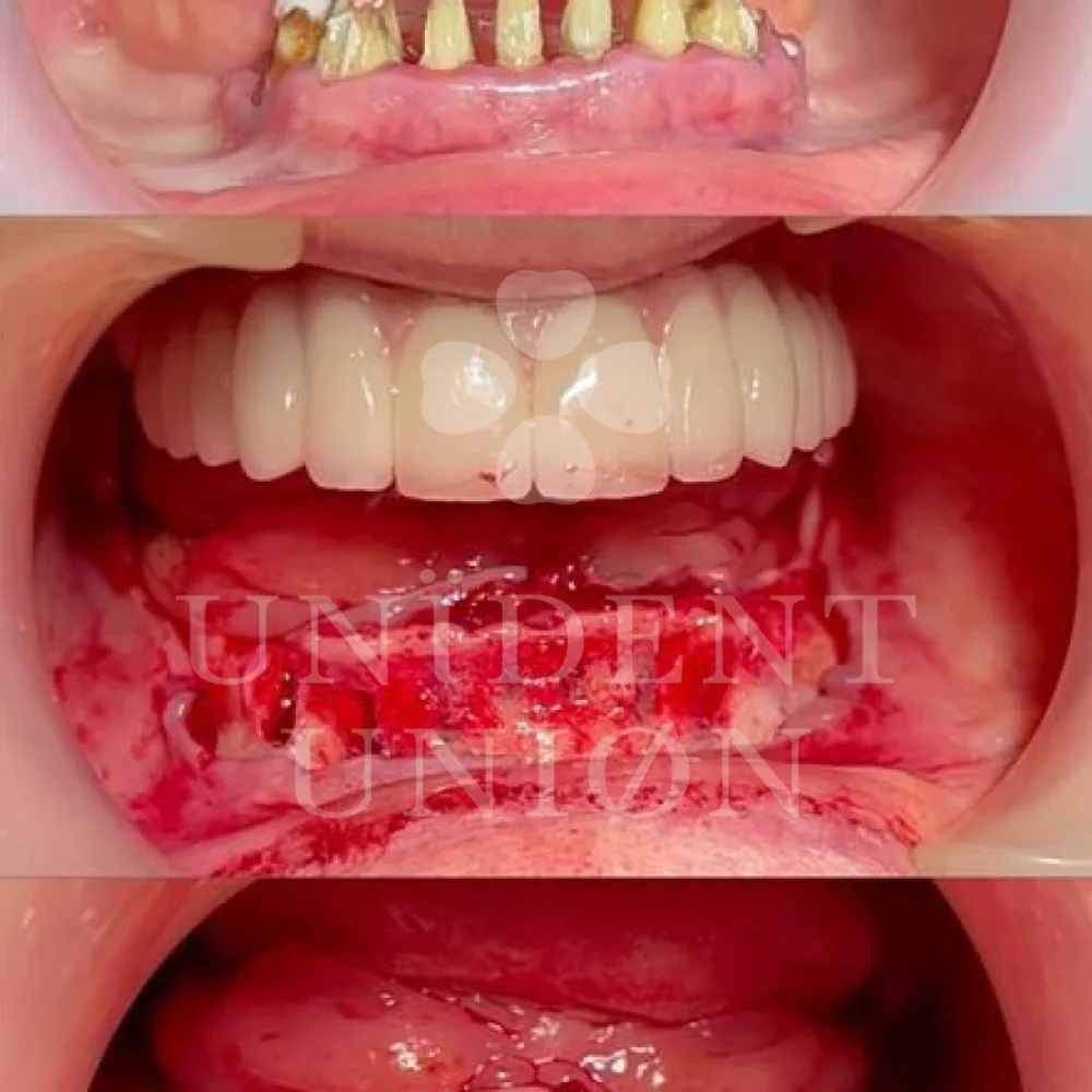 przypadek-2-chirurgia8