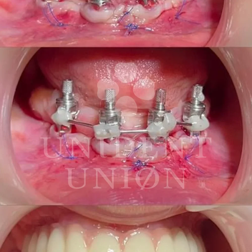 przypadek-2-chirurgia9