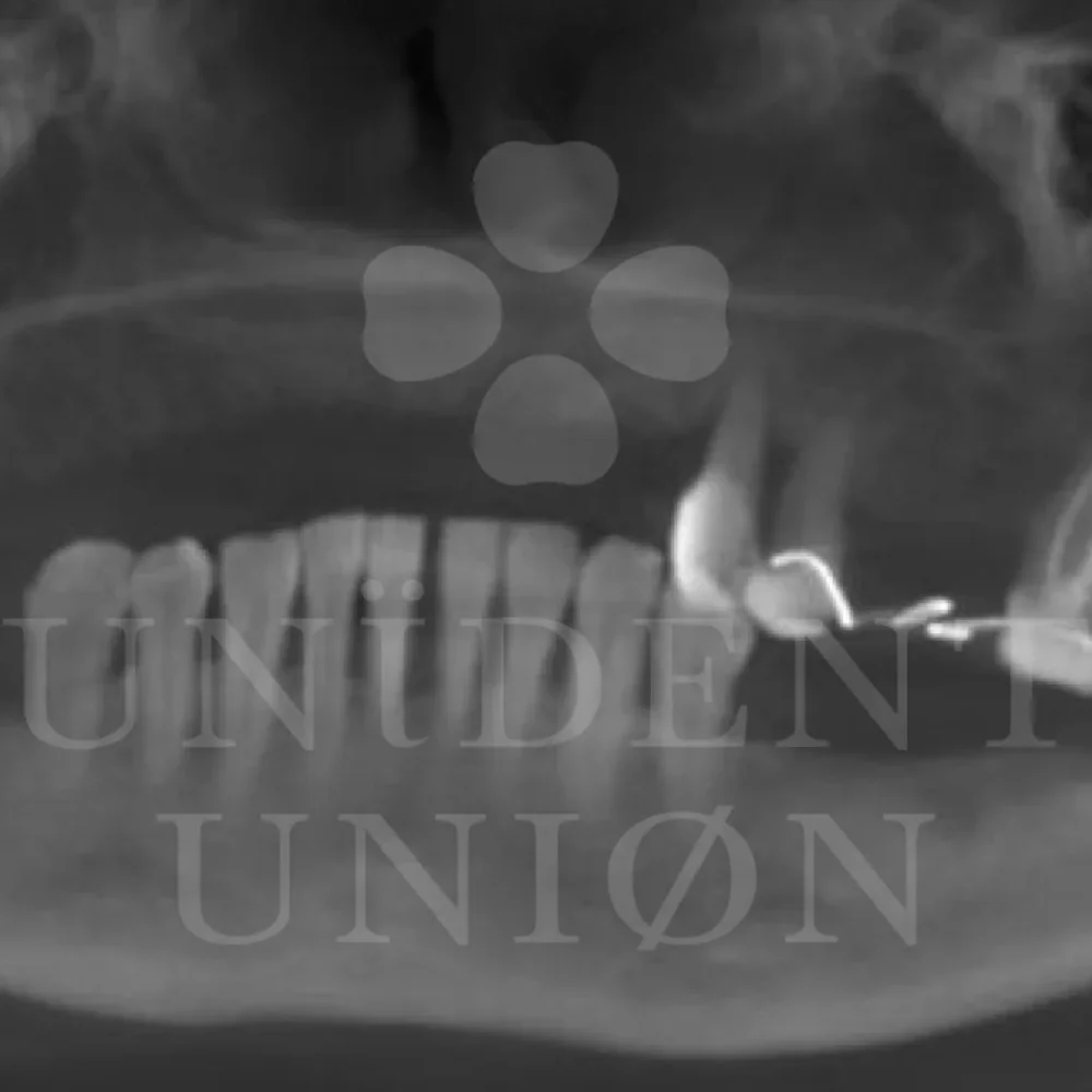 przypadek-3-chirurgia1