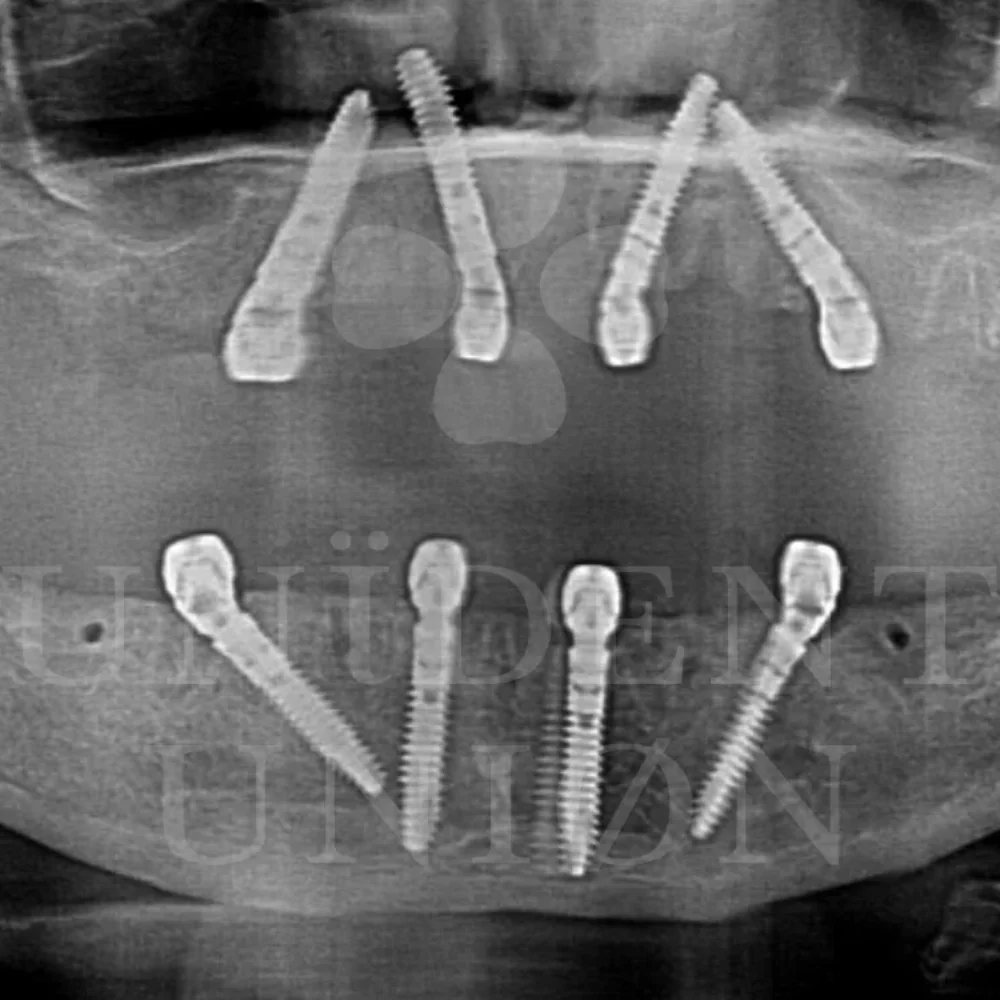 przypadek-3-chirurgia2