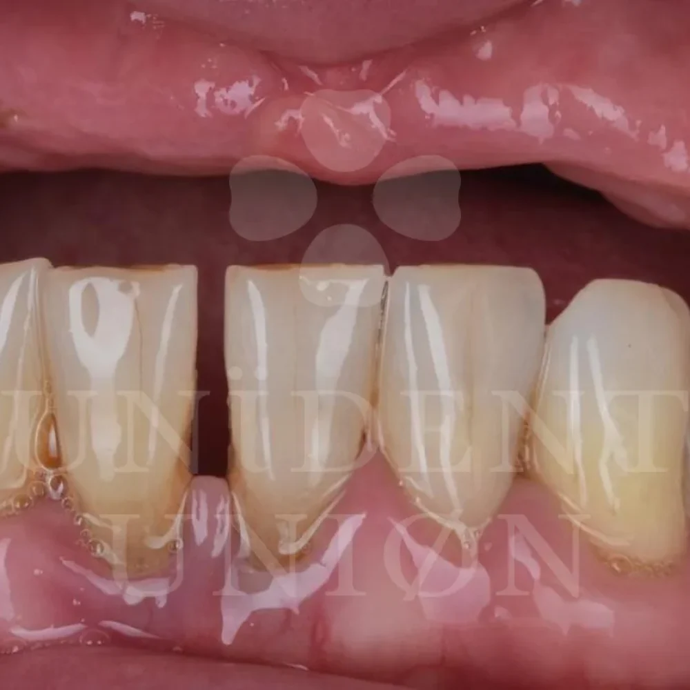 przypadek-3-chirurgia3