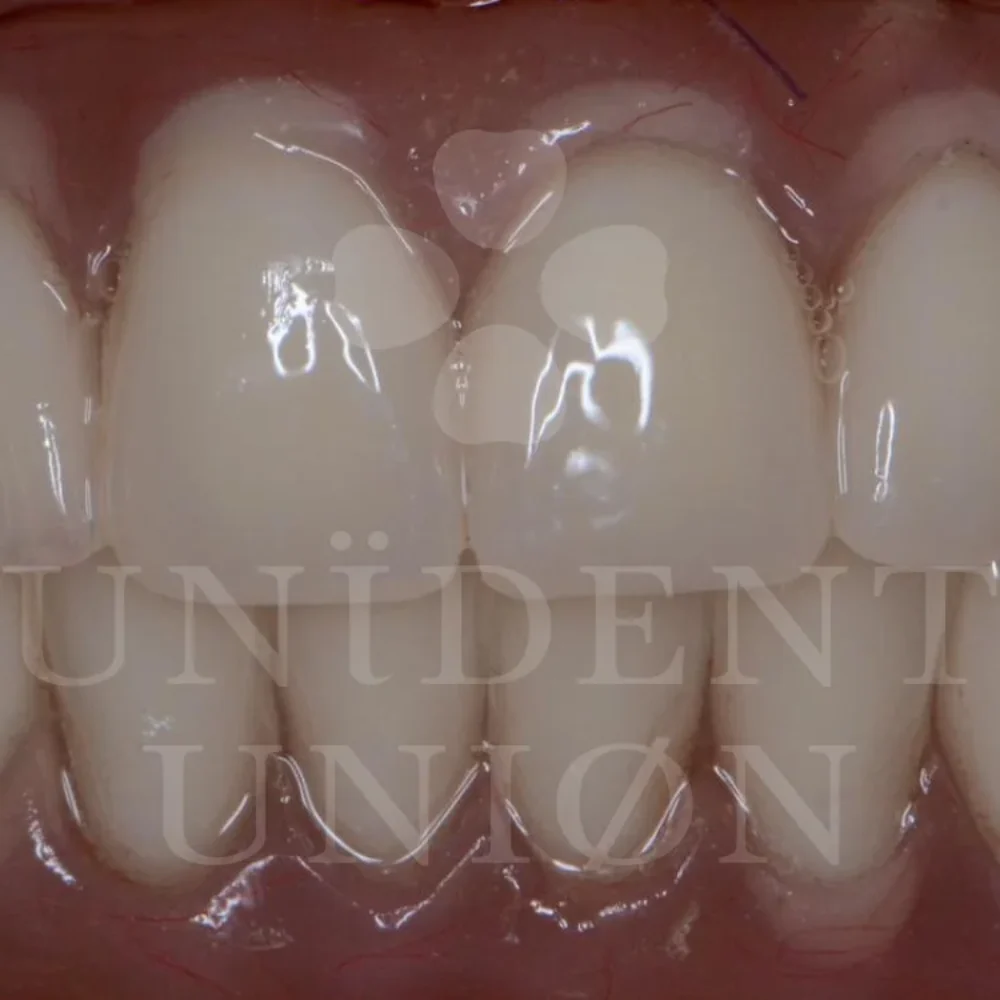 przypadek-3-chirurgia4