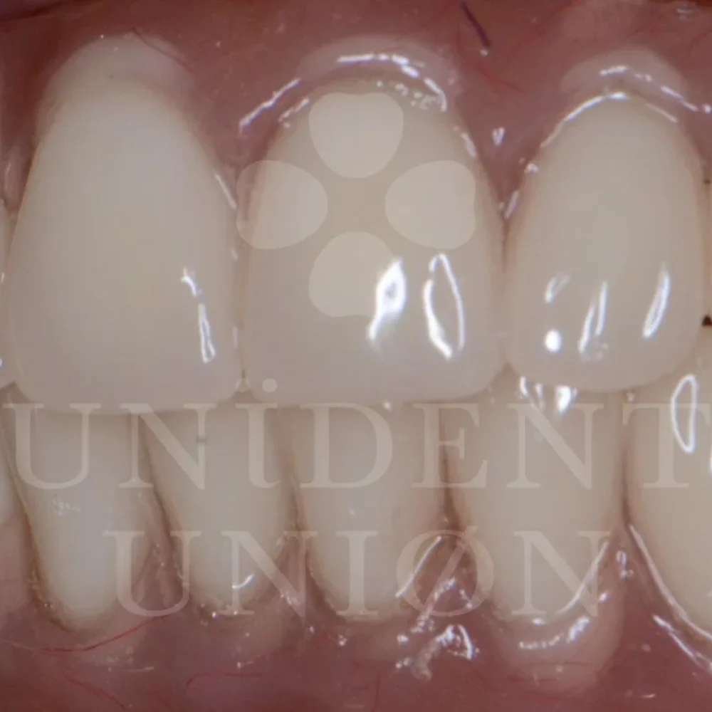 przypadek-3-chirurgia6