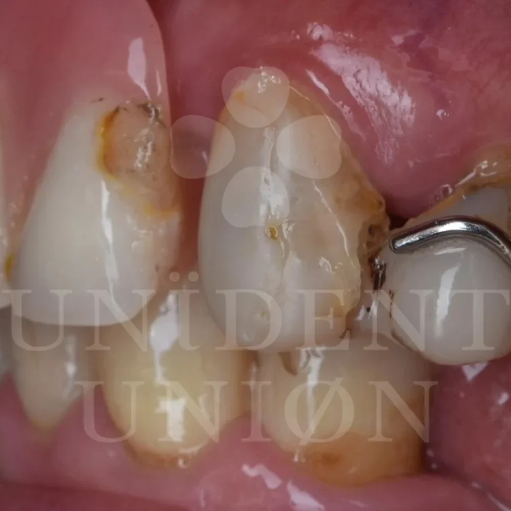 przypadek-3-chirurgia7